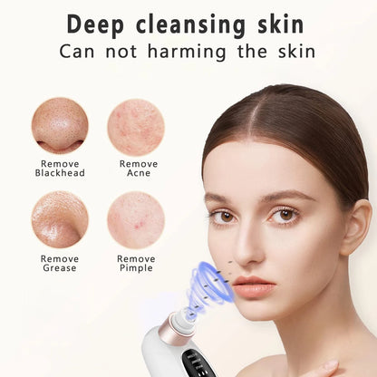 Rechargeable Blackhead Remover Vacuum | Deep Pore Cleanser & Acne Extractor