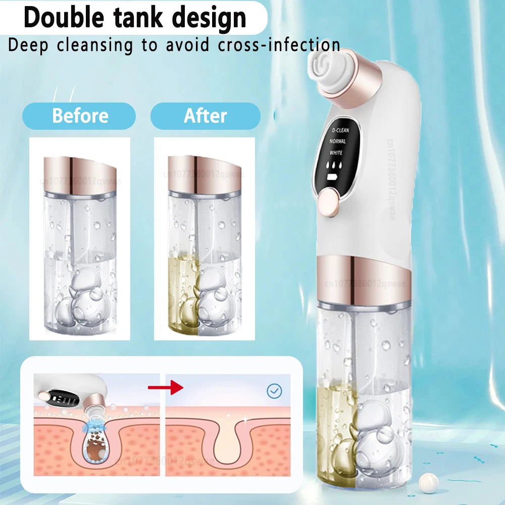 Rechargeable Blackhead Remover Vacuum | Deep Pore Cleanser & Acne Extractor