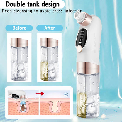 Rechargeable Blackhead Remover Vacuum | Deep Pore Cleanser & Acne Extractor