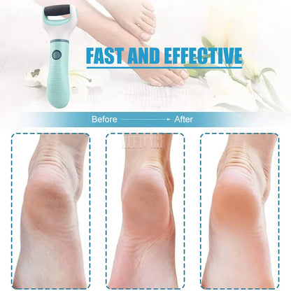 Electric Foot Callus Remover – Rechargeable & Waterproof Pedicure Tool