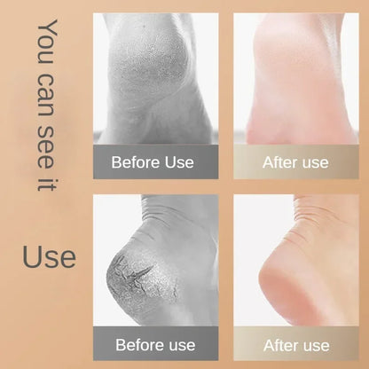 Silicone Heel Protectors Socks – Anti-Crack & Moisturizing Foot Care Sleeves
