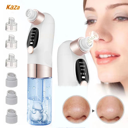 Rechargeable Blackhead Remover Vacuum | Deep Pore Cleanser & Acne Extractor