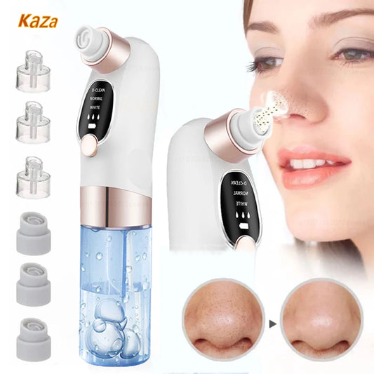 Rechargeable Blackhead Remover Vacuum | Deep Pore Cleanser & Acne Extractor