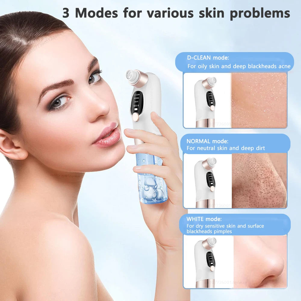 Rechargeable Blackhead Remover Vacuum | Deep Pore Cleanser & Acne Extractor