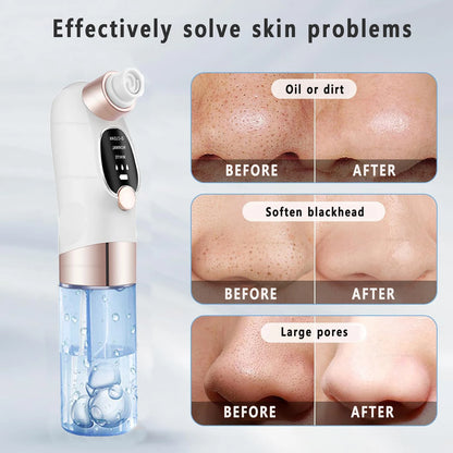 Rechargeable Blackhead Remover Vacuum | Deep Pore Cleanser & Acne Extractor