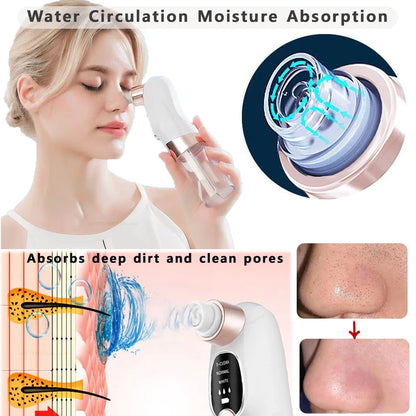 Rechargeable Blackhead Remover Vacuum | Deep Pore Cleanser & Acne Extractor
